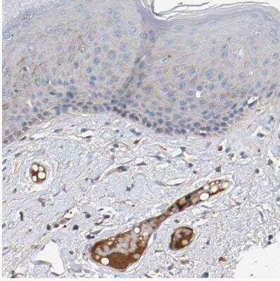 Immunohistochemistry-Paraffin: MAMDC2 Antibody [NBP1-81169] - Staining of human skin shows moderate positivity in plasma.