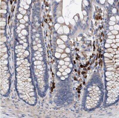 Immunohistochemistry-Paraffin: MAMDC2 Antibody [NBP1-81169] - Staining of human gastrointestinal shows moderate to strong cytoplasmic positivity in lymphoid cells.