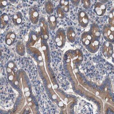 Immunohistochemistry-Paraffin: MAMDC2 Antibody [NBP1-81170] - Staining of human duodenum shows moderate cytoplasmic positivity in glandular cells.