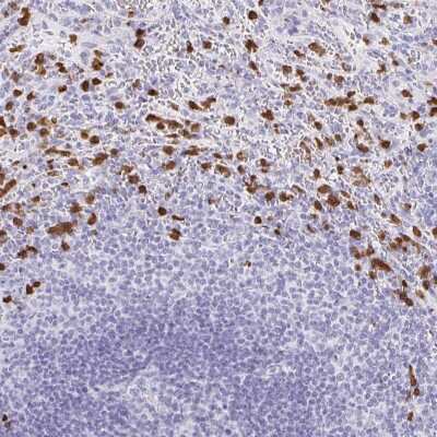 Immunohistochemistry-Paraffin: MAMDC4 Antibody [NBP2-57130] - Immunohistochemical staining of human spleen shows nuclear positivity in leukocytes.