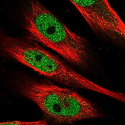 Immunocytochemistry/Immunofluorescence: MAML1 Antibody [NBP2-57191] - Staining of human cell line U-251 MG shows localization to nucleoplasm.