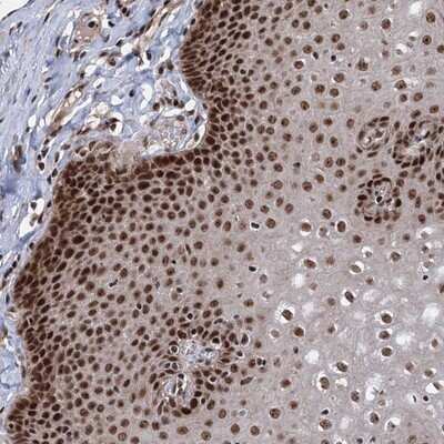 Immunohistochemistry-Paraffin: MAML1 Antibody [NBP1-83025] - Staining of human esophagus shows strong nuclear positivity in squamous epithelial cells.