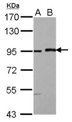 Western Blot: MAML1 Antibody [NBP1-33638] - Sample (30 ug of whole cell lysate) A: HeLa B: HeLa nucleus 7.5% SDS PAGE; antibody diluted at 1:1000.