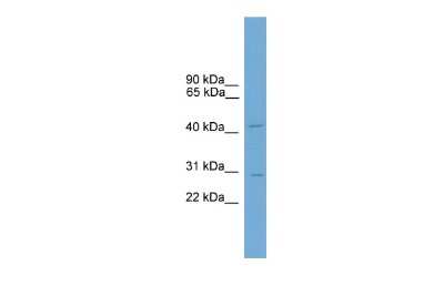 Western Blot: MAML2 Antibody [NBP3-10453] - Western blot analysis of MAML2 in Mouse Kidney as a positive control. Antibody dilution at 0.2-1 ug/ml