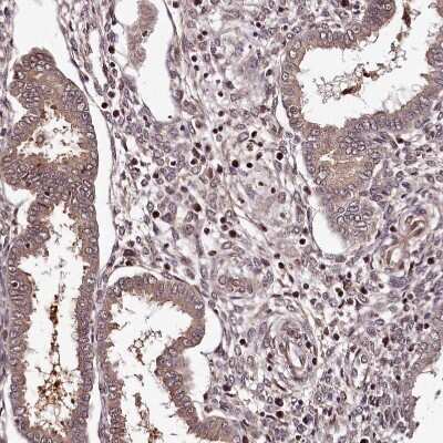 Immunohistochemistry-Paraffin: MAML3 Antibody [NBP1-86674] - Staining of human Endometrium shows moderate nuclear positivity in stromal and glandular cells.