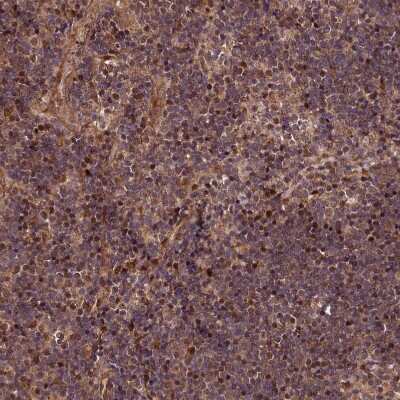 Immunohistochemistry-Paraffin: MAML3 Antibody [NBP1-86674] - Staining of human Lymph node shows moderate nuclear positivity in germinal center and non-germinal center cells.