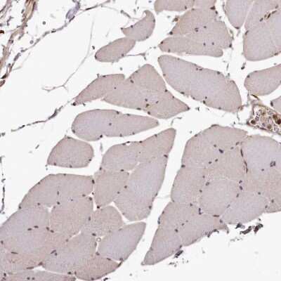 Immunohistochemistry-Paraffin: MAML3 Antibody [NBP1-86674] - Staining of human Skeletal muscle shows no positivity in myocytes as expected.