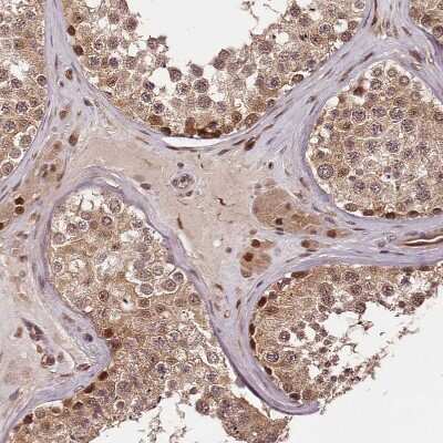 Immunohistochemistry-Paraffin: MAML3 Antibody [NBP1-86674] - Staining of human Testis shows moderate nuclear positivity in cells in seminiferous ducts and Leydig cells.