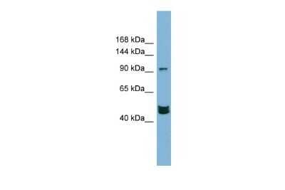 Western Blot: MAML3 Antibody [NBP3-09240] - Western blot analysis of MAML3 in PANC1 cell lysate as a positive control. Antibody dilution at 0.2-1 ug/ml