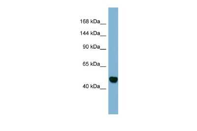 Western Blot: MAML3 Antibody [NBP3-09241] - Western blot analysis of MAML3 in Fetal Stomach lysates. Antibody dilution at 1.0ug/ml