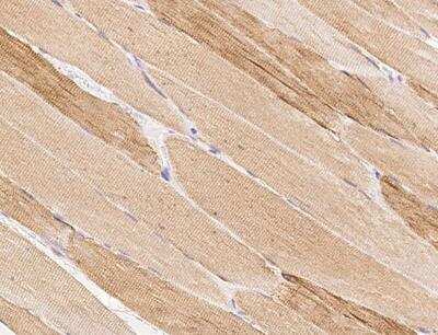 Immunohistochemistry-Paraffin: MAMLD1 Antibody [NBP3-12581] - Staining of human MAMLD1 in human skeletal muscle with rabbit polyclonal antibody at 1:300 dilution.