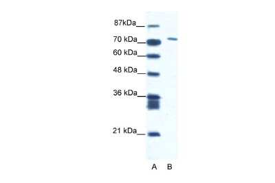 Western Blot: MAMLD1 Antibody [NBP2-83177] - WB Suggested Anti-CXORF6 Antibody Titration: 1.25ug/ml. ELISA Titer: 1:1562500. Positive Control: Jurkat cell lysate