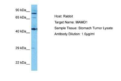 Western Blot: MAMLD1 Antibody [NBP2-83179] - Host: Rabbit. Target Name: MAMD1. Sample Type: Stomach Tumor lysates. Antibody Dilution: 1.0ug/ml