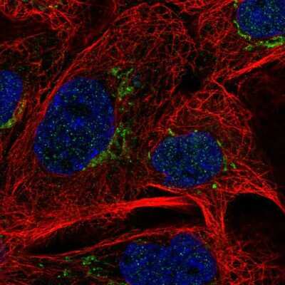 Immunocytochemistry/Immunofluorescence: MAN1A2 Antibody [NBP2-56757] - Staining of human cell line A-431 shows localization to the Golgi apparatus.