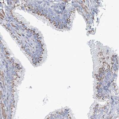 Immunohistochemistry-Paraffin: MAN1A2 Antibody [NBP1-82802] - Staining of human prostate shows strong granular cytoplasmic positivity in glandular cells.