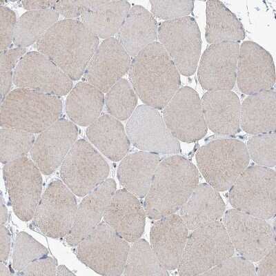 Immunohistochemistry-Paraffin: MAN1A2 Antibody [NBP1-82802] - Staining of human skeletal muscle shows very weak positivity in myocytes.