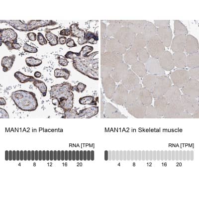 Immunohistochemistry-Paraffin MAN1A2 Antibody - BSA Free