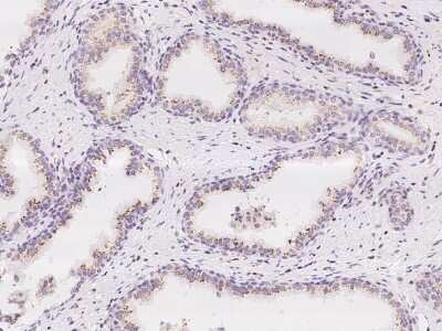 Immunohistochemistry-Paraffin: MAN1A2 Antibody [NBP2-97194] - Immunochemical staining of human MAN1A2 in human prostate with rabbit polyclonal antibody at 1:100 dilution, formalin-fixed paraffin embedded sections.