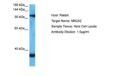 Western Blot: MAN2A2 Antibody [NBP2-87774] - Host: Rabbit. Target Name: MAN2A2. Sample Tissue: Human Hela Whole Cell. Antibody Dilution: 1.0ug/ml