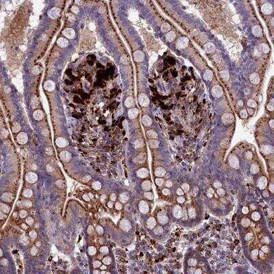 Immunohistochemistry-Paraffin: MAN2B1 Antibody [NBP1-81326] - Staining of human small intestine shows strong granular cytoplasmic positivity in glandular cells.