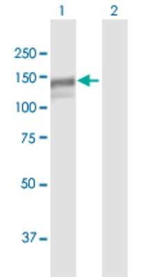 Western Blot: MAN2B1 Antibody [H00004125-B01P] - Analysis of MAN2B1 expression in transfected 293T cell line by MAN2B1 polyclonal antibody.  Lane 1: MAN2B1 transfected lysate(111.21 KDa). Lane 2: Non-transfected lysate.