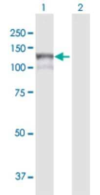 Western Blot: MAN2B1 Antibody [H00004125-D01P] - Analysis of MAN2B1 expression in transfected 293T cell line by MAN2B1 polyclonal antibody.Lane 1: MAN2B1 transfected lysate(113.70 KDa).Lane 2: Non-transfected lysate.