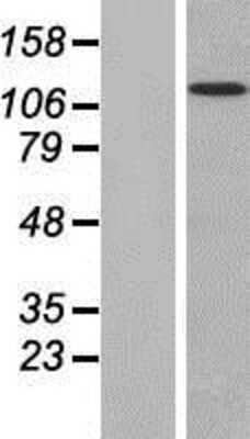 Western Blot: MAN2B2 Overexpression Lysate (Adult Normal) [NBP2-07195] Left-Empty vector transfected control cell lysate (HEK293 cell lysate); Right -Over-expression Lysate for MAN2B2.