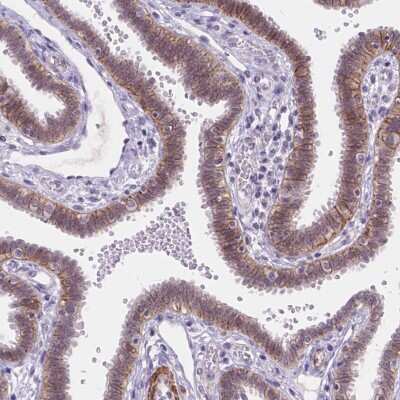 Immunohistochemistry-Paraffin: MAN2C1 Antibody [NBP2-57246] - Immunohistochemical staining of human fallopian tube shows cytoplasmic positivity in glandular cells.