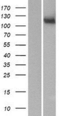 Western Blot MAN2C1 Overexpression Lysate