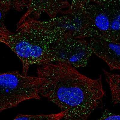 Immunocytochemistry/ Immunofluorescence MANBA Antibody - BSA Free