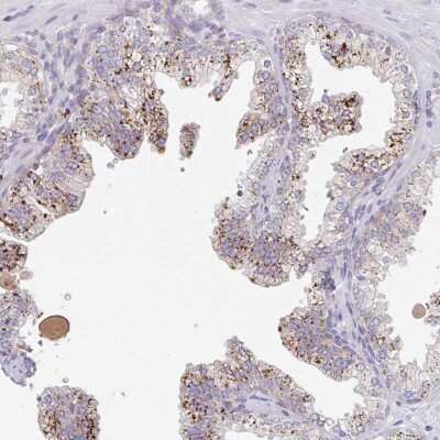 Immunohistochemistry-Paraffin: MANBA Antibody [NBP2-47384] - Staining of human prostate shows strong cytoplasmic positivity, with a granular pattern in glandular cells.