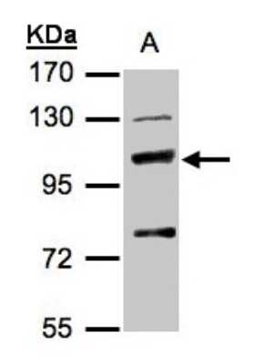 Western Blot: MANBA Antibody [NBP1-32355] - Sample(30 ug of whole cell lysate)A:Hep G2 7. 5% SDS PAGE, antibody diluted at 1:500.