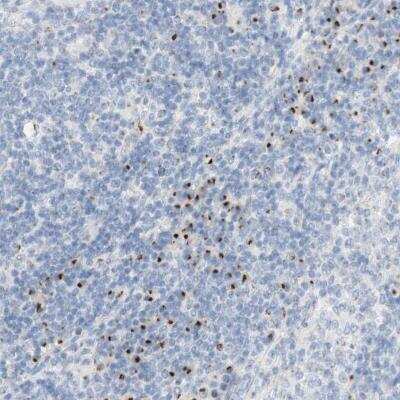 Immunohistochemistry-Paraffin: MANEA Antibody [NBP1-82279] - Staining of human lymph node shows moderate positivity in non-germinal center cells.