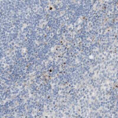 Immunohistochemistry-Paraffin: MANEA Antibody [NBP1-83710] - Staining of human lymph node shows moderate positivity in non-germinal center cells.