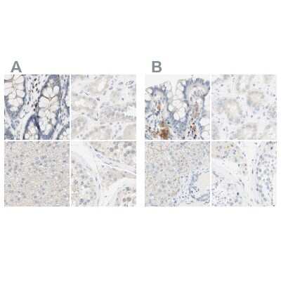 <b>Independent Antibodies Validation. </b>Immunohistochemistry-Paraffin: MANEA Antibody [NBP1-83710] - Staining of human colon, kidney, liver and testis using Anti-MANEA antibody NBP1-83710 (A) shows similar protein distribution across tissues to independent antibody NBP1-82279 (B).