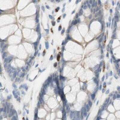 Immunohistochemistry-Paraffin: MANEA Antibody [NBP1-83710] - Staining of human colon.