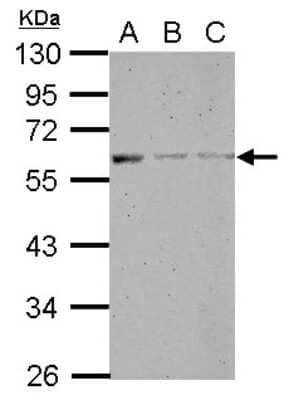 Western Blot: MANEA Antibody [NBP2-17214] - Sample (30 ug of whole cell lysate) A: A431 B: HeLa C: HepG2 10% SDS PAGE gel, diluted at 1:1000.