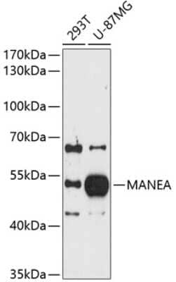 Western Blot: MANEA Antibody [NBP3-04940] - Analysis of extracts of various cell lines, using MANEA antibody at 1:1000 dilution. Secondary antibody: HRP Goat Anti-Rabbit IgG (H+L) at 1:10000 dilution. Lysates/proteins: 25ug per lane. Blocking buffer: 3% nonfat dry milk in TBST. Detection: ECL Basic Kit