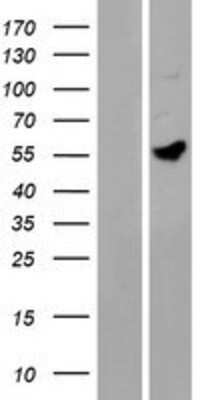 Western Blot: MANEAL Overexpression Lysate (Adult Normal) [NBP2-09385] Left-Empty vector transfected control cell lysate (HEK293 cell lysate); Right -Over-expression Lysate for MANEAL.