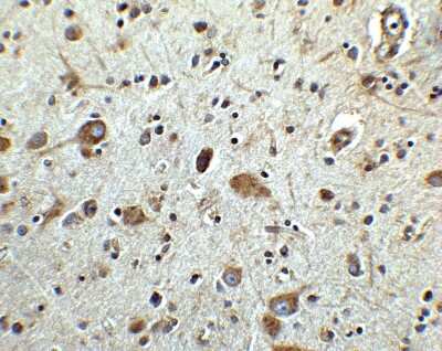 Immunohistochemistry: MANF Antibody [NBP1-76836] - Analysis of MANF in human brain tissue with MANF antibody at 2.5 ug/ml.