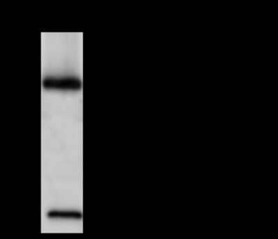 Immunoprecipitation: MANF Antibody [NBP2-99775] - MANF was immunoprecipitated using: Lane A: 0.5 mg 293T Whole Cell Lysate 4ul anti-MANF rabbit polyclonal antibody and 60 ug of Immunomagnetic beads Protein A/G.  Primary antibody: Anti-MANF rabbit polyclonal antibody, at 1:100 dilution. Secondary antibody: Goat Anti-Rabbit IgG (H+L)/HRP at 1/10000 dilution. Developed using the ECL technique. Performed under reducing conditions. Predicted band size: 21 kDa. Observed band size: 17 kDa