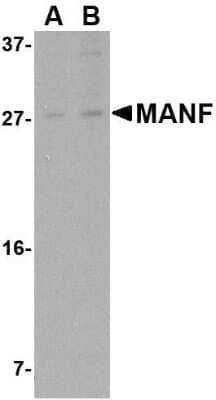 Western Blot: MANF Antibody [NBP1-76837] - Rat brain tissue lysate with ARMET antibody at (A) 1 and (B) 2 ug/mL.