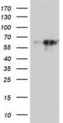 Western Blot: MAO-A Antibody (2F10) [NBP2-01752] - HEK293T cells were transfected with the pCMV6-ENTRY control (Left lane) or pCMV6-ENTRY MAO-A Antibody (Right lane) cDNA for 48 hrs and lysed. Equivalent amounts of cell lysates (5 ug per lane) were separated by SDS-PAGE and immunoblotted with anti-MAO-A Antibody