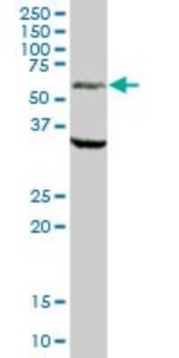 Western Blot: MAO-A Antibody [H00004128-B01P] - Analysis of MAOA expression in human liver.