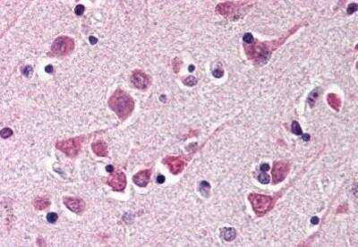 Immunohistochemistry-Paraffin: MAP1 Antibody [NBP1-02988] - Staining of human brain, cortex. Immunohistochemistry of formalin-fixed, paraffin-embedded tissue after heat-induced antigen retrieval. Antibody concentration 5 ug/ml.