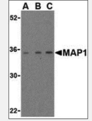Western Blot: MAP1 Antibody [NBP1-02988] - MAP-1 in EL4 cell lysate with MAP-1 antibody (IN) at (A) 1, (B) 2, and (C) 4 ug/ml.