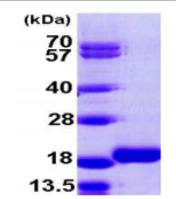 SDS-Page: Recombinant Human LC3B2 Protein [NBP1-99115] - 15% SDS-PAGE (3ug)