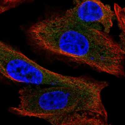 Immunocytochemistry/Immunofluorescence: MAP1S Antibody [NBP2-47383] - Staining of human cell line PC-3 shows localization to cytosol. Antibody staining is shown in green.