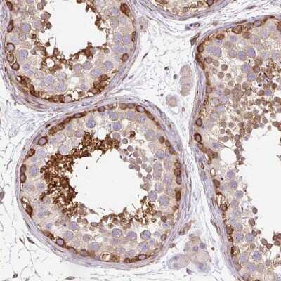 Immunohistochemistry-Paraffin: MAP1S Antibody [NBP2-47383] - Staining of human testis shows strong cytoplasmic positivity in subsets of cells in seminiferus ducts.