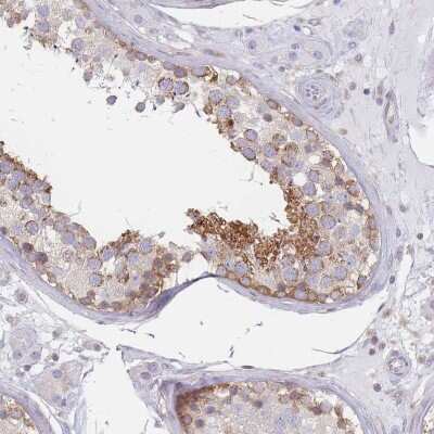 Immunohistochemistry-Paraffin: MAP1S Antibody [NBP2-48987] - Staining of human testis shows moderate cytoplasmic positivity in cells in seminiferous ducts.